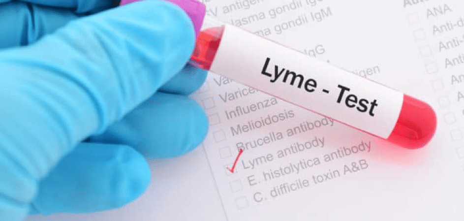 Lyme testen en behandelen