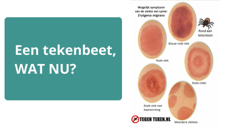 Wat Te Doen Na Een Tekenbeet LymeHerstel wat-te-doen-na-een-tekenbeet-lymeherstel